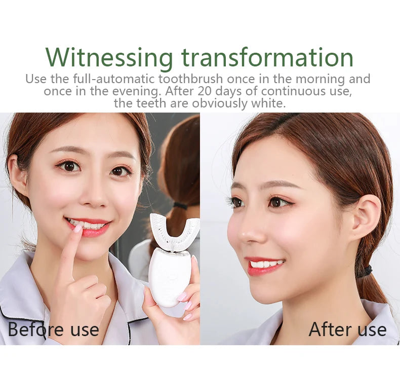 **U-Type Sonic Electric Toothbrush – 360° Automatic Cleaning, USB Rechargeable & Waterproof**