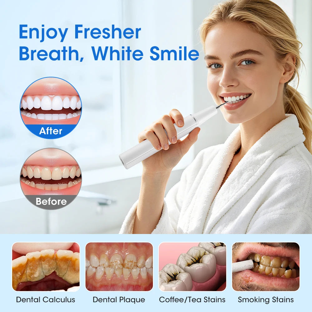 **Ultrasonic Dental Scaler – Electric Tartar, Plaque & Stain Remover**
