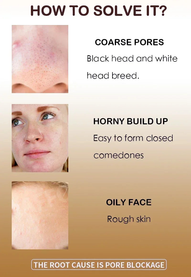 **Pore Refining Face Serum – Oil Control, Hydration & Skin Smoothing Care**