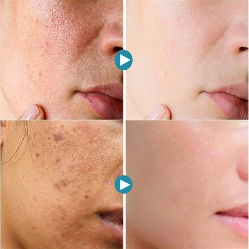 **Pore Refining Face Serum – Oil Control, Hydration & Skin Smoothing Care**