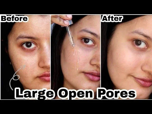 **Pore Refining Face Serum – Oil Control, Hydration & Skin Smoothing Care**