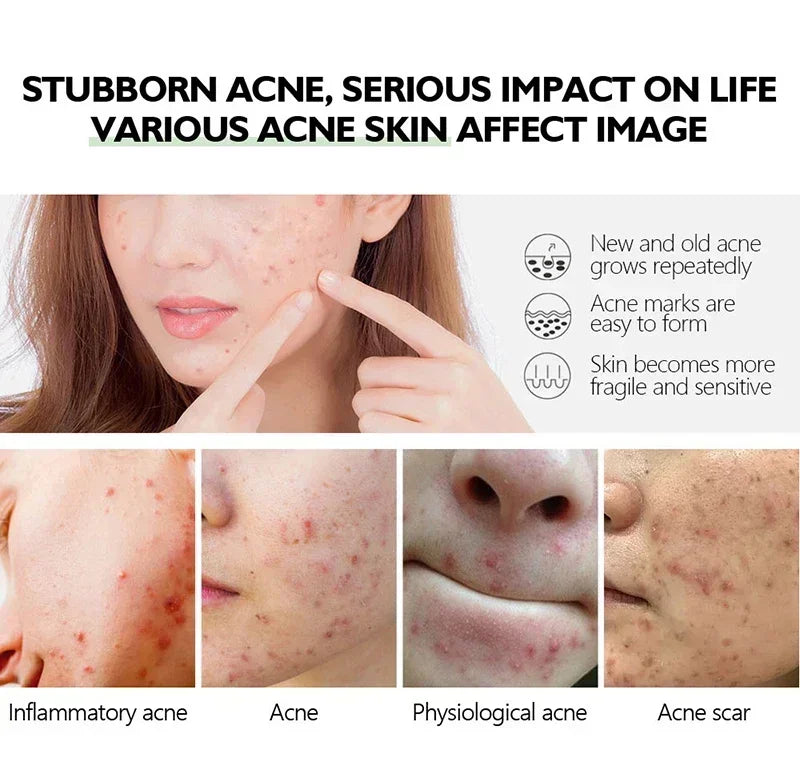 **Pore Refining Face Serum – Oil Control, Hydration & Skin Smoothing Care**