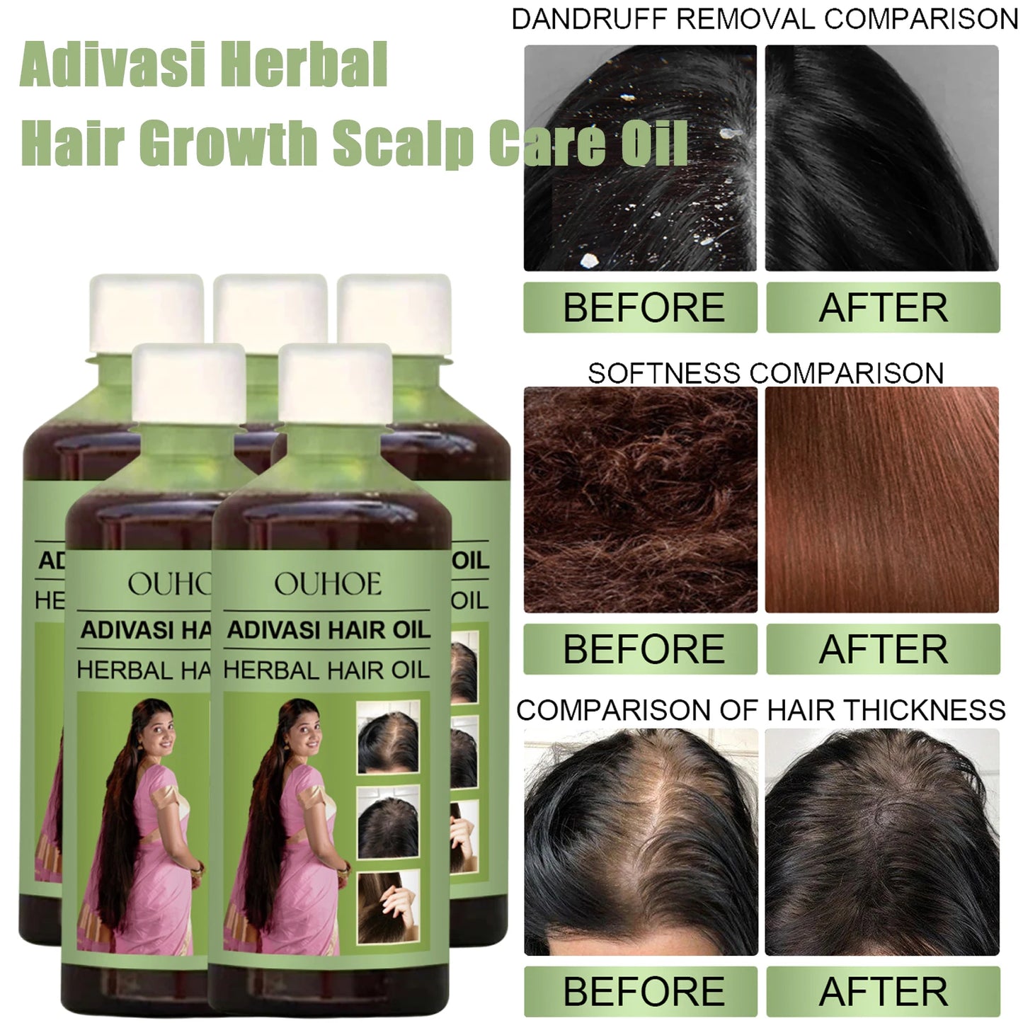 **100ml Adivasi Herbal Hair Oil – Rosemary Scalp & Hair Care**