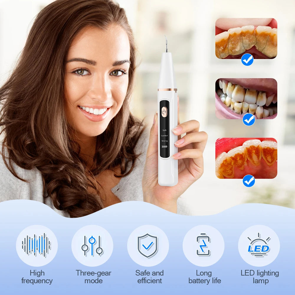 **Ultrasonic Dental Scaler – Electric Tartar, Plaque & Stain Remover**
