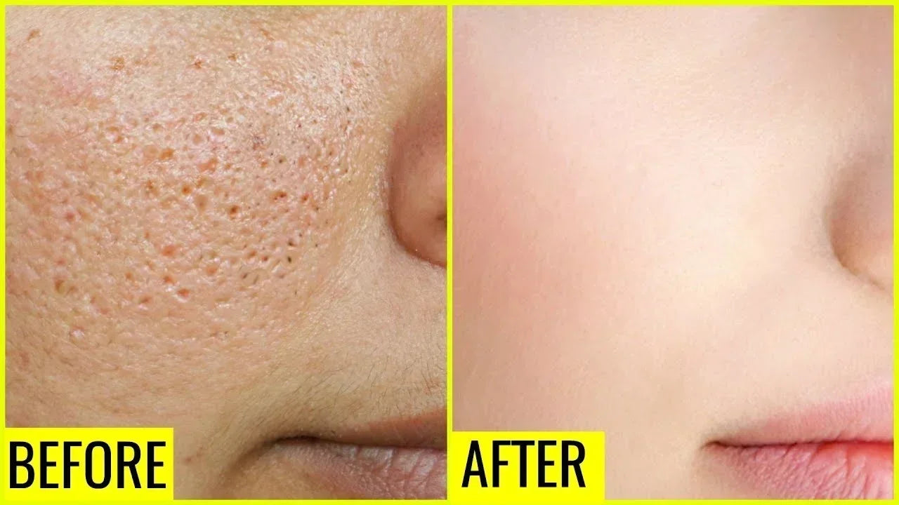 **Pore Refining Face Serum – Oil Control, Hydration & Skin Smoothing Care**