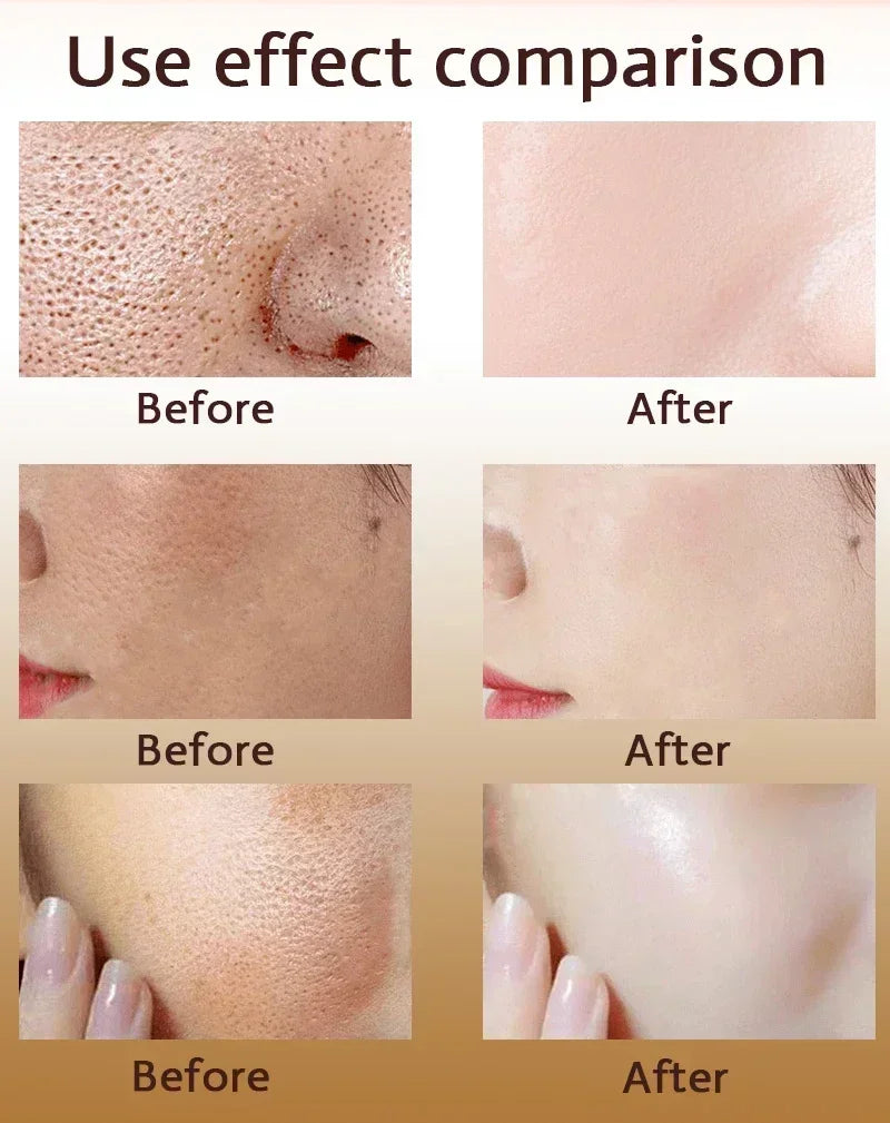 **Pore Refining Face Serum – Oil Control, Hydration & Skin Smoothing Care**