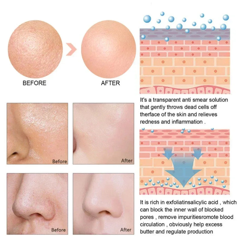 **Pore Refining Face Serum – Oil Control, Hydration & Skin Smoothing Care**